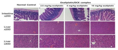 경구용 Oxaliplatin/DCK 이온결합 복합체의 간, 소장에서의 조직학적 평가