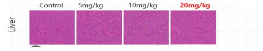 Doxorubicin/DOCA 경구투여 후 간세포의 조직학적 평가