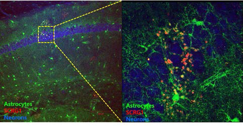 알츠하이머 병 모델 쥐 뇌에서 존재하는 별아교세포에서 선택적으로 발현 증가하는 SCRG1