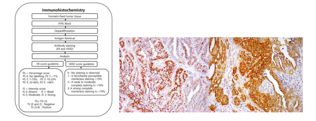 Immunohistochemistry 실험 flow-chart, Estrogen receptor, HER-2 IHC 실험 사진