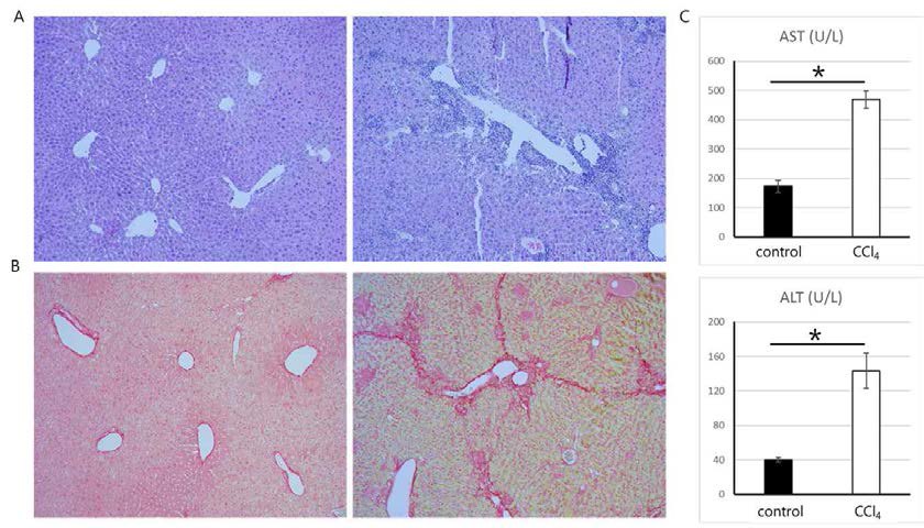 사염화탄소 유래 간섬유화 모델 제작 및 분석. A.간조직의 H 우, 사염화탄소 유래 간섬유화 모델 마우스), B.간조직의 Sirius Red 염색 (좌, control mice; 우, 사염화탄소 유래 간섬유화 모델 마우스), C, 혈청분석. 간 효소 아스파르트산 아미노전달효소(AST, Aspartate Aminotransferase)(상)와 알라닌 아미노전달효소(ALT, Alanine Aminotransferase)(하)