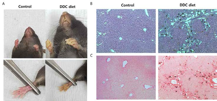 DDC diet 유래 담즙정체성 간섬유화 모델 제작 및 분석. A.0.1% DDC(3,5-diethoxycarbonyl-1,4-dihydrocollidine) diet와 normal diet 마우스 사진, B. 간조직의 H&E 염색, C.간조직의 Sirius Red 염색