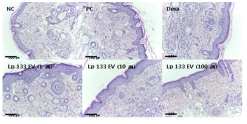 황색포도상구균 (S. aureus) 유래소포에 의한 아토피피부염 마우스모델에서 유산균 유래소포 피부투여 시 조직학적인 변화