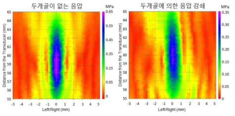 두개골 유무에 따른 음압 차이