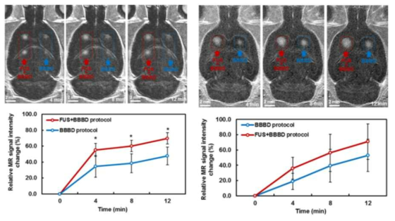 MRI와 조영제의 intensity 비교 (좌) Normal rat (우) Brain tumor model