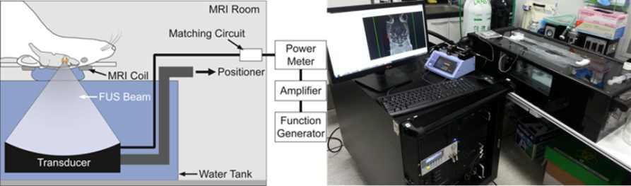 구축된 MR영상유도 집중 초음파 시스템