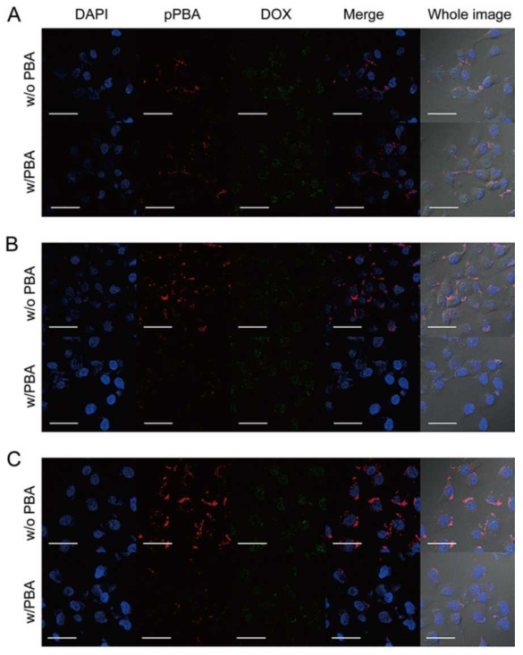 세포주에서 시행한 나노구조체의 세포내 유입 실험 및 경쟁적 유입 실험. A)nanocomplex 1, B) nanocomplex 2, C) nanocomplex 4 이며 MCF-7 세포주에 처리 해준 후 공초점 현미경을 이용하여 분석. 파란색은 세포 핵, 붉은색은 나노구조체, 초록색은 DOX를 나타냄