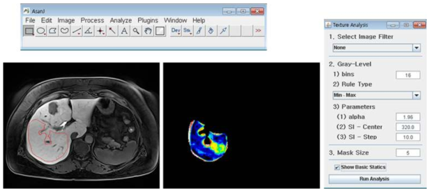 자체 개발된 Texture analysis s/w