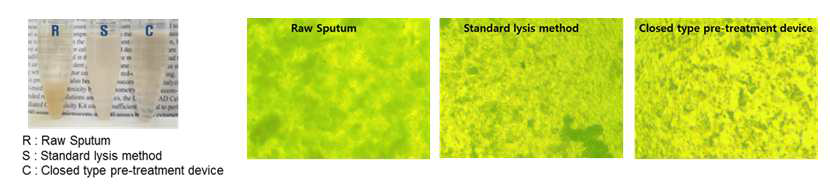 육안 및 현미경을 통한 액화 효율 비교