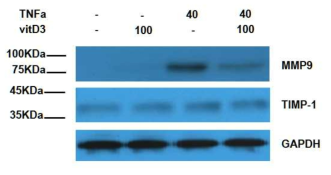 TNF-α와 TIMP-1의 MMP-9의 발현