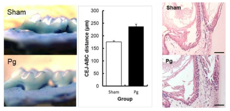 P. gingigvalis 접종으로 유도한 생쥐 치주염 모델: 치조골 파괴/치은조직