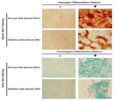 정상인 세포와 당뇨병 세포(췌도 유래 중간엽줄기세포)의 멀티리니지 분화 비교