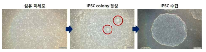 섬유아세포 및 췌도세포에서 유도만능줄기세포 유도 과정