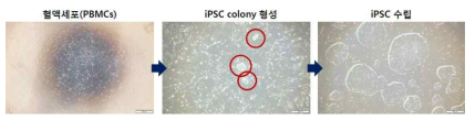 혈액세포(PBMCs)의 유도만능줄기세포 유도 과정