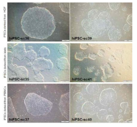 각 인체조직으로부터 유래된 유도만능줄기세포