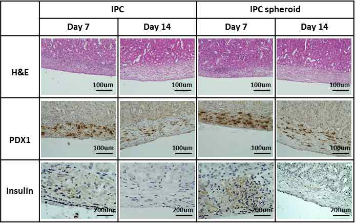 신장 피막에 인슐린 생성세포 및 구상체 이식후 PDX1 유전자 발현 및 인슐린 발현 세포 조직학적 분석