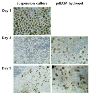 유도만능 줄기세포 유래 인슐린 생성세포 구상체의 장기간 배양에 따른 형태 변화. 돼지 췌장탈세포 세포외기질을 이용한 hydrogel 배양에 따른 구상체 형태 변화 확인