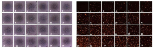 지방줄기세포에 BMP2 유전자 이입 후 24가지 microporation 조건 형광발현을 효율 확인