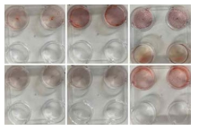Alizarin Red staining을 통한 인체유래 지방줄기세포라인의 골분화 효율 확인