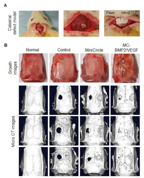 BMP2와 VEGF 이입된 지방줄기세포 이식후 두개골 결손 모델(calvarial defect model)에서의 골형성 유도 및 골재생 효과 확인