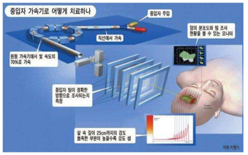 중입자 치료기 및 영상화 원리 (출처 : 지멘스)