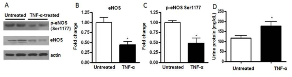 TNF-α에 의한 eNOS 발현과 인산화