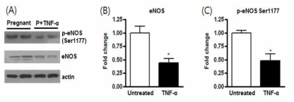 TNF-α에 의한 eNOS 발현과 불활성화