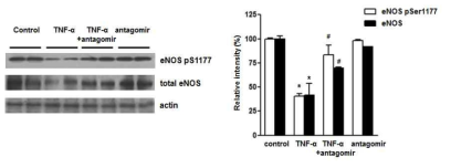 miRNA-214 antagomir의 eNOS 발현과 인산화