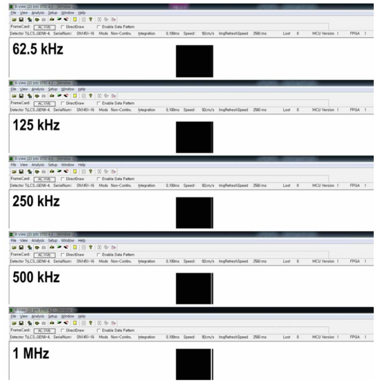 Detection Technology사의 영상 획득 소프트웨어를 사용하여 캡처한 각 주기 (62.5 kHz, 125 kHz, 250 kHz, 500 kHz, 1 Mhz)에 따른 영상