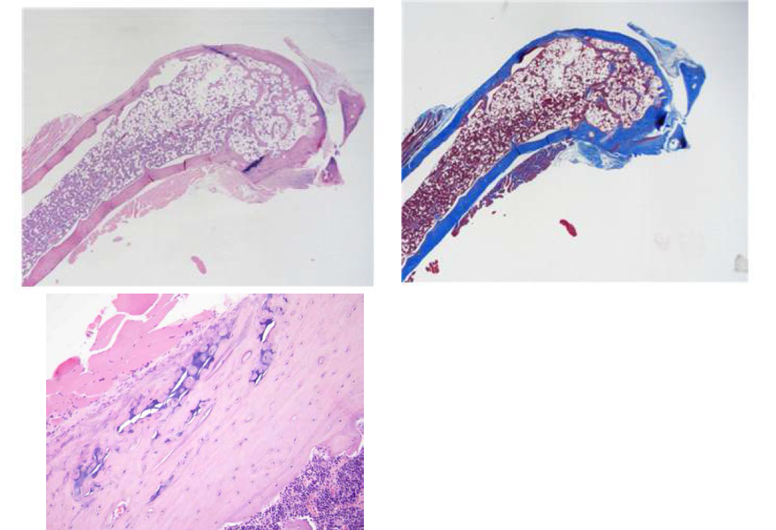 대퇴골두의 골조직 H-E 염색 및 masson trichrome 염색