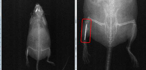 수술 후 Digital radiography 영상