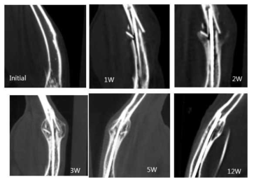 Micr CT상에서 BPA 고농도에 노출된 군에서 골유합 정도 OVX Control 군에서 2주부터 유합이 진행 되기 시작하였으며 가골은 3주에 최대로 형성 되었다. 최대 가골 형성은 Initial의 경골 단면적의 85% 가량으로 증가 하였다