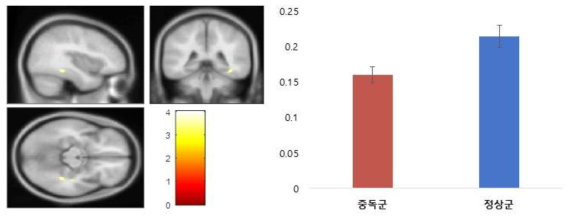 집단 간 구조적 변화가 나타난 해마 내 영역