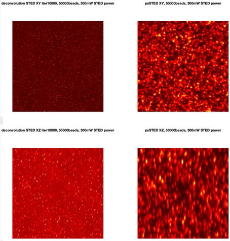 Background noise를 줄이는 방법 중 psSTED의 경우 Deconvolution보다 선명한 이미 지를 보여준다. 특히 XZ cross-section에 대하여 더 높은 PSBR을 보이는 것을 알 수 있다