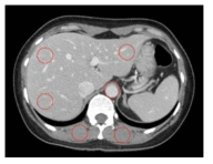 Location of region interest(ROI) for evaluationg the quantitative image quality