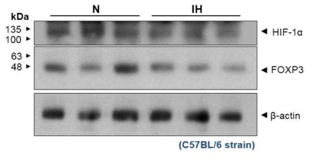 간헐적 저산소군(IH)과 정상 산소군(N)의 Foxp3, HIF-1α 발현 차이. 간헐적 저산소군에서 더 높은 Foxp3발현을 보여주었다