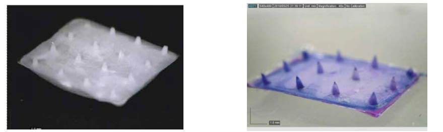 Porous silk microneedle scaffold(좌)와 porous silk microneedle filled with PVP-PVA-MAA polymer(우)