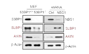 53BP1과 NBS1에 의한 SLBP, AXIN1 발현변화