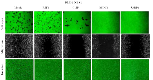 NBS1 결합단백질들의 암형성 및 암진행 영향 평가 NBS1 과발현 DLD1 세포에 각각을 발현시켜 soft agar, migraion 및 invasion을 비교 관찰함
