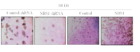 NBS1의 종양형성 효능 Soft agar assay를 이용하여 NBS1 결핍 또는 과발현 된 DLD1 에서확인