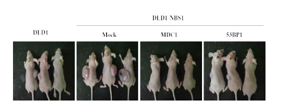 마우스 모델에서 효능 검증 NBS1 과발현 DLD1 세포에 MDC1과 53BP1 을 발현 시킨 후 종양 형성을 관찰함