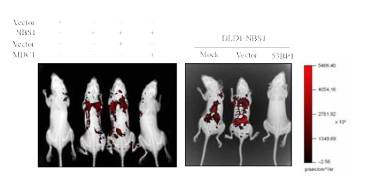 종양 전이 평가 (Left) NBS1에 의한 종양 전이에 MDC1 (Left) 과 53BP1 (left)의 효능검증