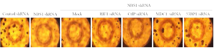 암줄기세포 형성 평가 NBS1 결핍세포에 NBS1 결합단백질들을 발현하여 sphere forming assay를 통하여 암줄기세포 형성을 관찰함