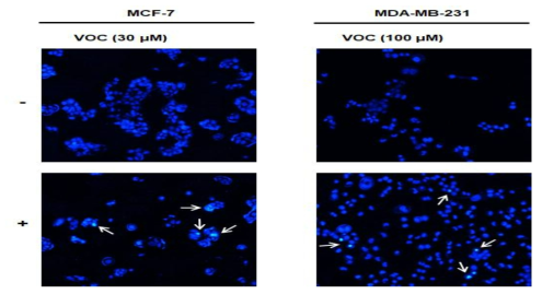 cis-hexenal의 유방암세포 apoptosome 형성효과