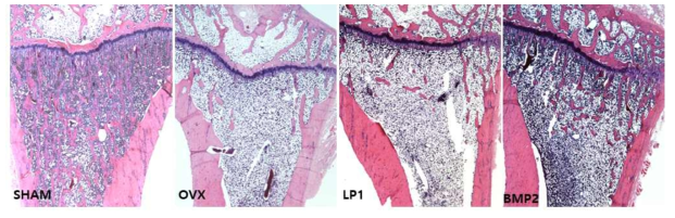 Hematoxylin & Eosin (H&E) stain