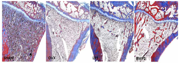 Masson’s trichrome stain