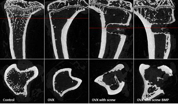 BMP-2 분비 나사못 삽입후 경골의 micro CT 소견