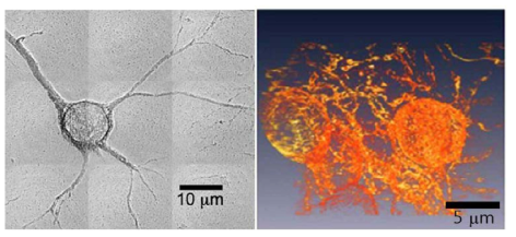 2012년 미국 APS에서 발표한 엑스선 나노 CT를 이용한 쥐의 뉴런의 2차원 투과 이미지와 3차원 랜더링 이미지