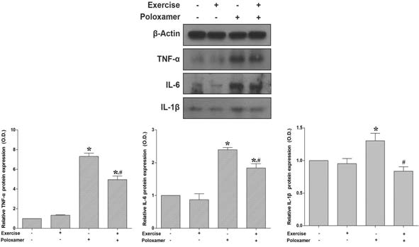 트레드밀 운동이 대동맥 염증성 사이토카인에 미치는 영향. *represents P < 0.05 compared to non-exercise group. #represents P < 0.05 compared to the poloxamer group