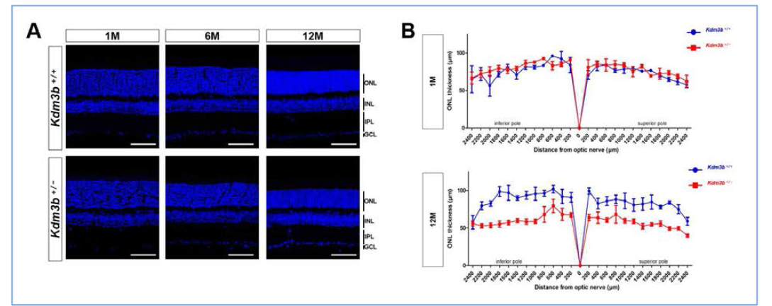 Kdm3b KO 생쥐 망막 조직의 특징 분석 (A,B) 1개월령 및 12개월령 생쥐의 망막을 사용하여 망막 전체에 걸쳐 조직의 두께를 측정하였음
